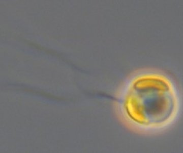 Celle av Chrysochromulina leadbeateri sett med differensiell interferenskontrast (DIC) lysmikroskopi.
