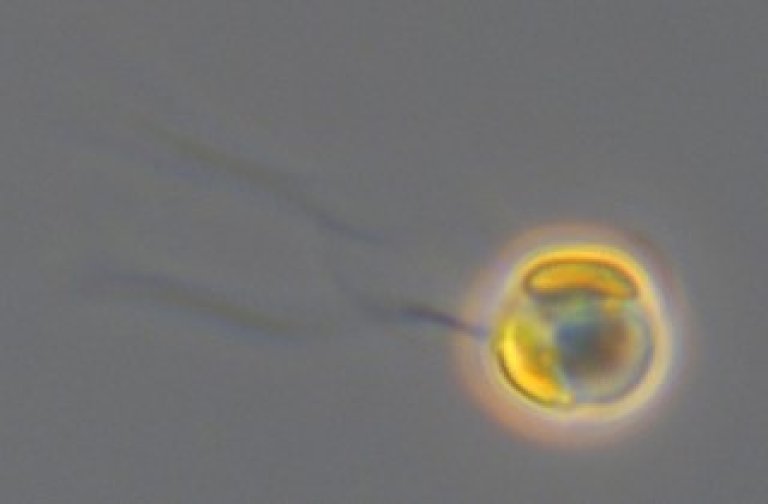 Celle av Chrysochromulina leadbeateri sett med differensiell interferenskontrast (DIC) lysmikroskopi. Foto: Bente Edvardsen, UiO