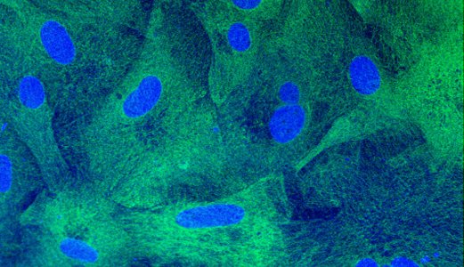 The Norwegian Veterinary Institute will develop faster and more specific diagnostics and replace experimental animals with organ models