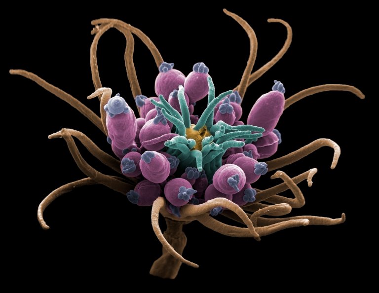JWN_II_Hydroid_web