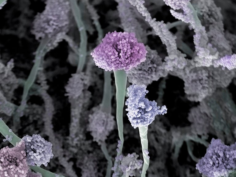  The mold Aspergillus fumigatus taken with a scanning electron microscope and colorized. Photo: Jannicke Wiik Nielsen, The Norwegian Veterinary Institute