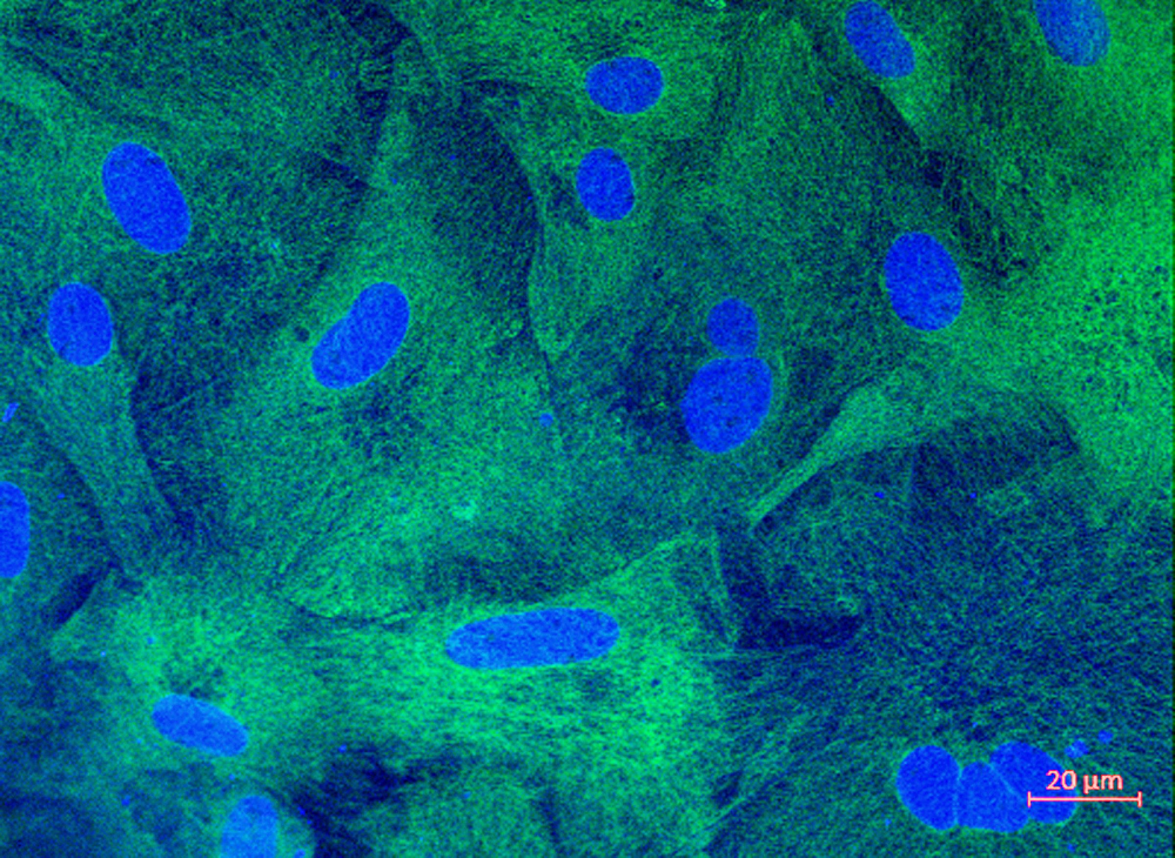 Establishing and characterizing new fish cell lines will be an important basic activity in the strategic institute initiative BIO-DIRECT. The picture shows epithelial cells from Lumpsucker fish brought through the Institute's initiative on cell cultures associated with in-vitro methods (3R). »Photo: Hilde Sindre and Anita Solhaug, the Norwegian Veterinary Institute.