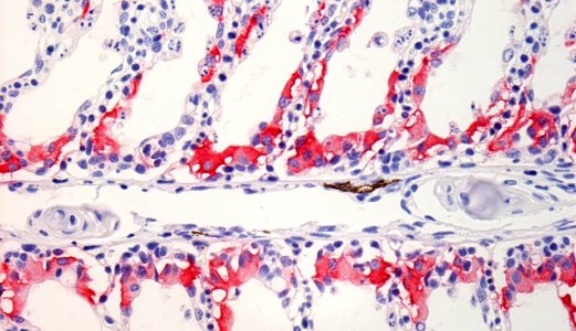 Ny kunnskap om laksepox-virus og gjellesykdom