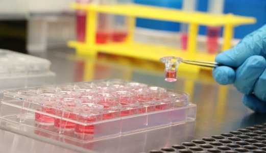 Muggsoppresistens kan bli like stor trussel som antibiotikaresistens