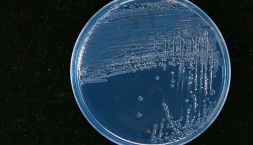 Utbrudd av salmonellasmitte