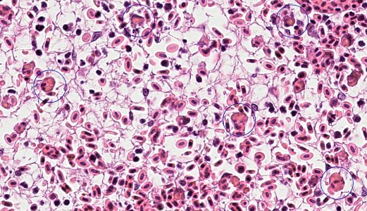 Infeksiøs lakseanemi og biosikkerhetsutfordringer