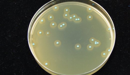 Undersøker prøver for Listeria