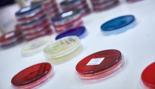 Helsemyndighetene etterforsker nasjonalt utbrudd av salmonella