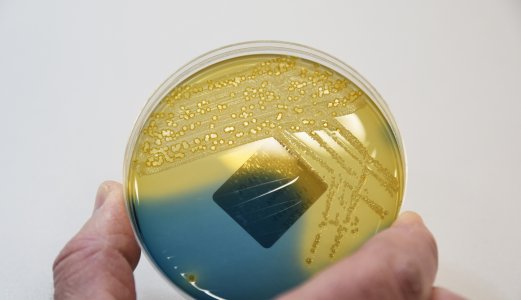 Utbruddsetterforskning igangsatt etter at seks personer har fått E.coli-infeksjon