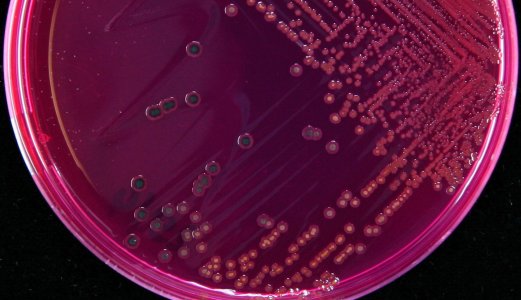 Funn av Salmonella i sesamfrøprodukter