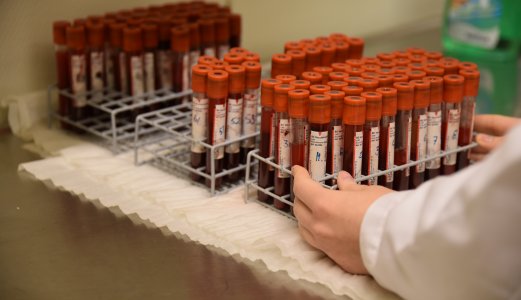 Forlenget svartid på analyser