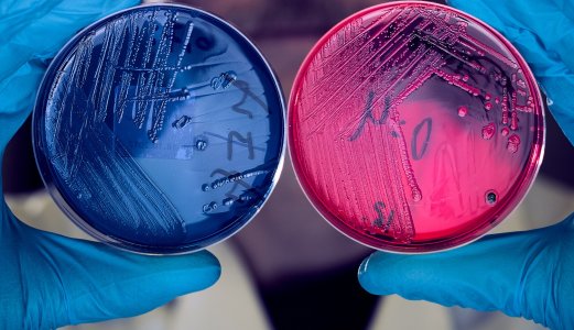 Fortsatt høy og økende resistens mot enkelte viktige antibiotika