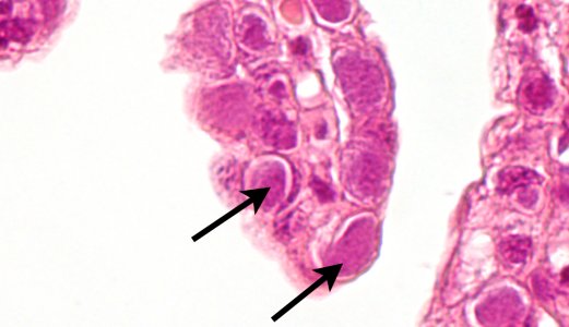 Ny kunnskap om «epiteliocystis» hos laks
