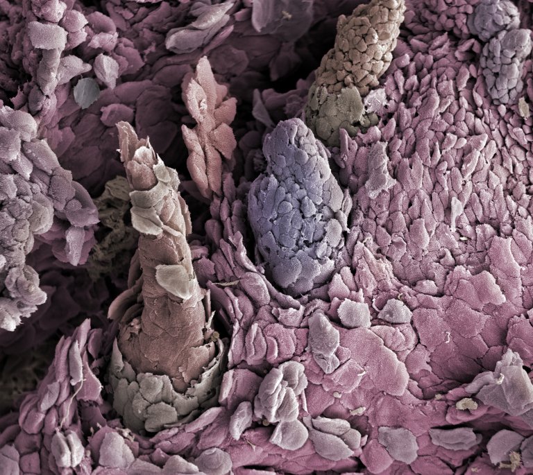 Tungens overflate – forstørret 120 ganger. Utvekstene, papillene, gir tungen den ruglete overflaten. Foto: Jannicke Wiik-Nielsen