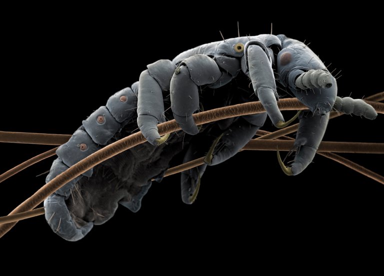 Hodelus på hårstrå – forstørret 200 ganger. Selv om lus verken kan hoppe eller fly, sprer de seg raskt ved å krabbe fra hårstrå til hårstrå når hoder kommer tett sammen. Foto: Jannicke Wiik-Nielsen, Veterinærinstituttet.