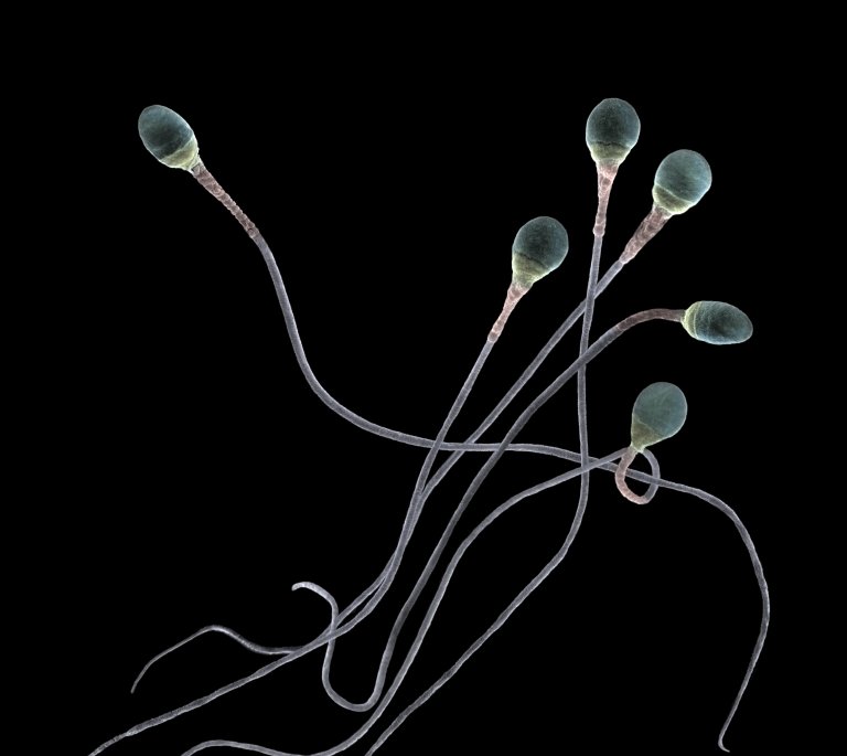 Sædceller – forstørret 10 000 ganger. En mann lager flere hundre milliarder sædceller i løpet av livet , nok til å befolke hele jordkloden. Foto: Jannicke Wiik-Nielsen, Veterinærinstituttet