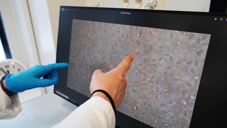 Ved hjelp av lysmikroskopi kan forskerne evaluere morfologi hos røde blodceller etter tre dagers eksponering for det kortisol lignende agonisten deksametason. Foto: Mari M. Press, Veterinærnstituttet                      