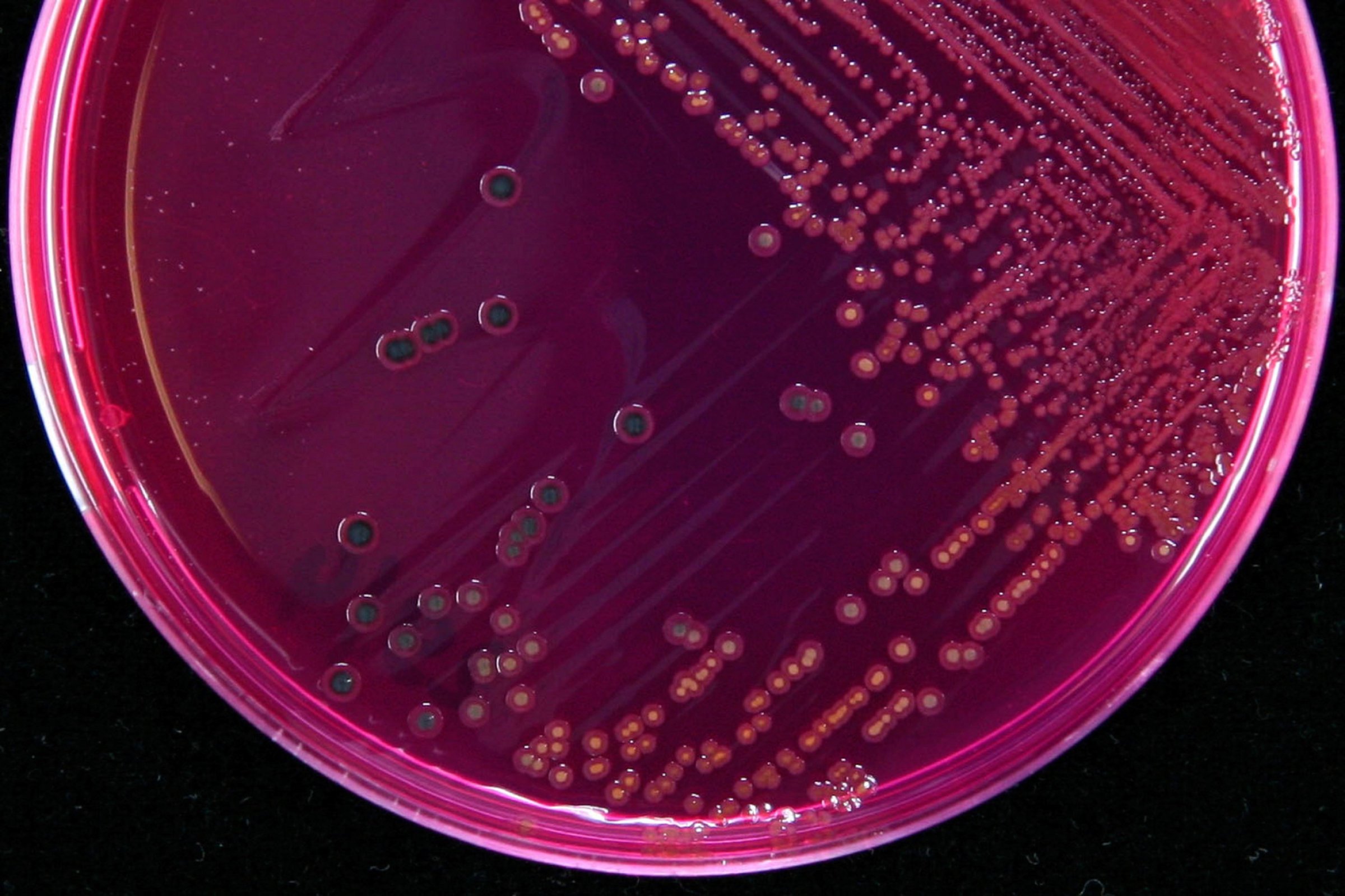 Det er funnet flere varianter av Salmonella i importerte sesamfrøprodukter. De aktuelle produktene er trukket til bake fra markedet. undersøkelser vil vise om funnene av Salmonella i de aktuelle sesamfrøproduktene kan knyttes opp mot flere tilfeller av salmonellose i Norge. Illustrasjonsfoto: Espen Skjolsvik