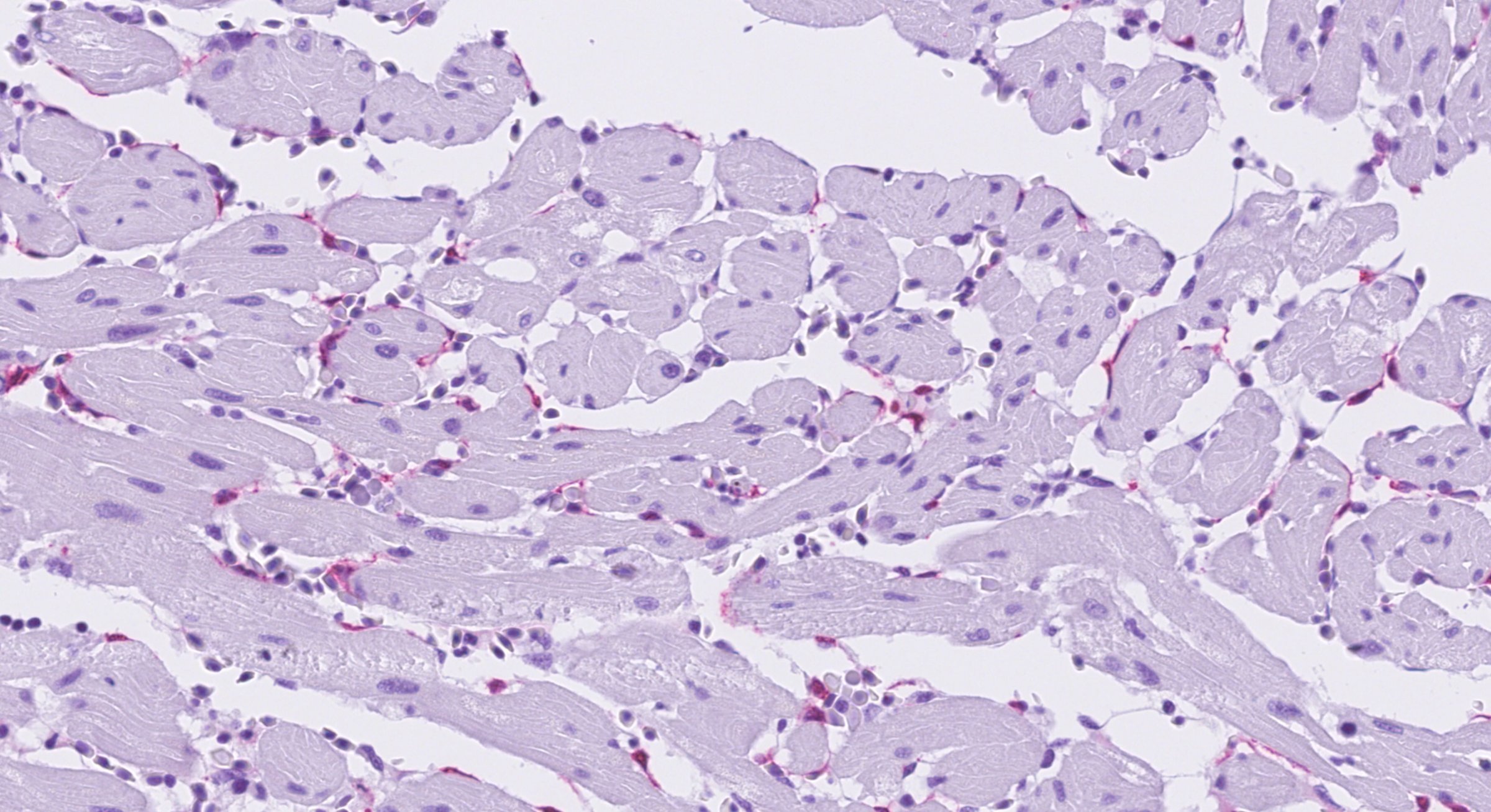 Bilde viser en positiv immunhistokjemi (rød merking) i hjertet på en laks med infeksiøs lakseanemi (ILA). Foto: Geir Bornø