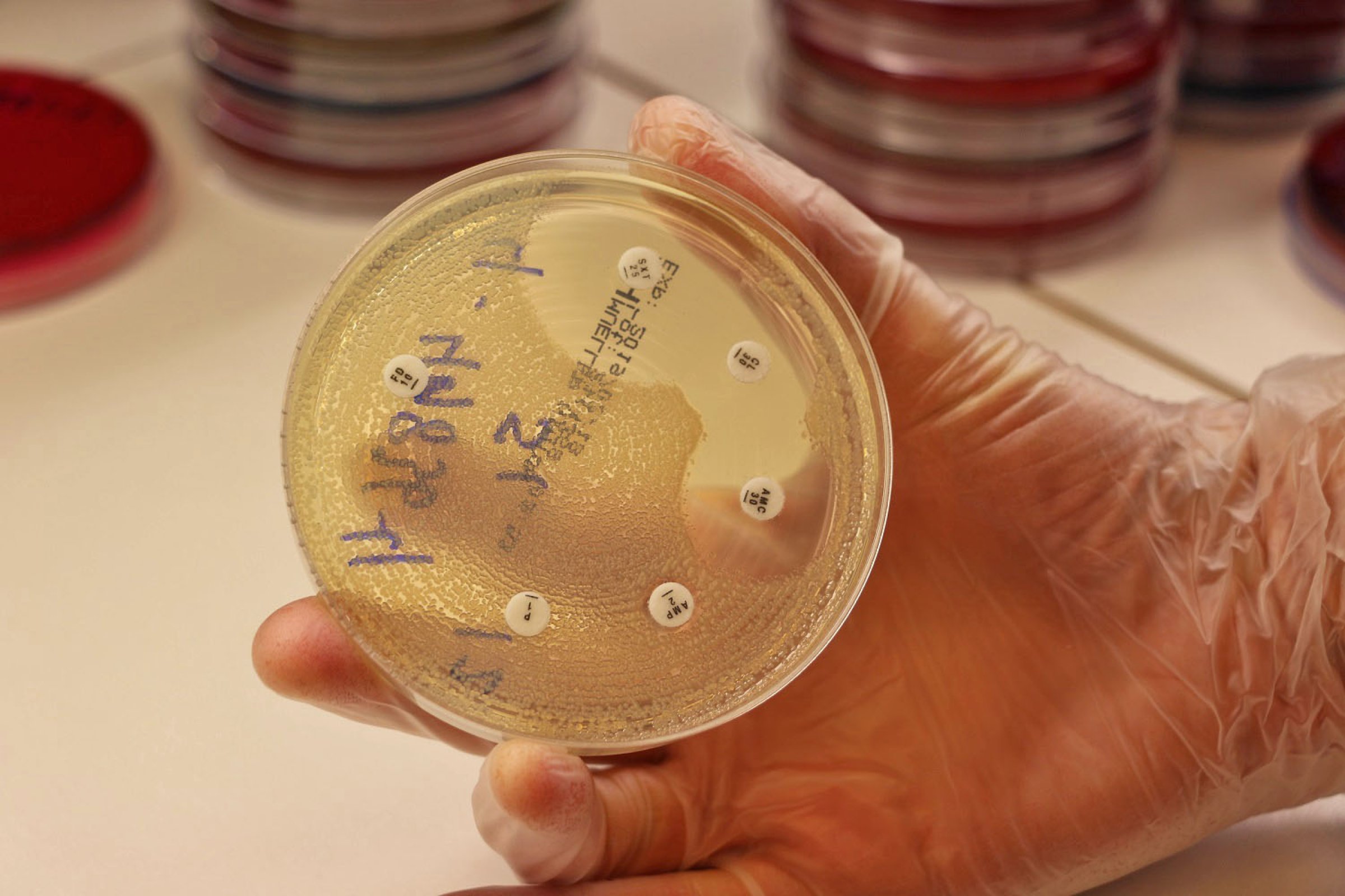 Bakterievekst rundt lapper med antibiotika avslører eventuell resistens. Foto: Bryndis Holm