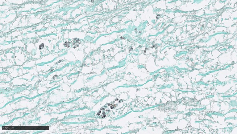 Vill fisk har en kompleks helse med mange funn. Her Myxobolus lignende parasitter i den forlengede marg (i hjernen) hos sjøørret fra Sokna. Foto: Toni Erkinharju, Veterinærinstituttet 