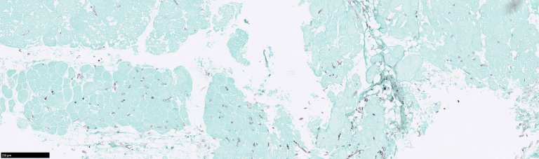 Bildet viser muskulatur i grønt og hyfer av saprolegnia som tverrsnitt og langsgående snitt i svart. Farget med Grocott. Foto: Toni Erkinharju, Veterinærinstituttet 