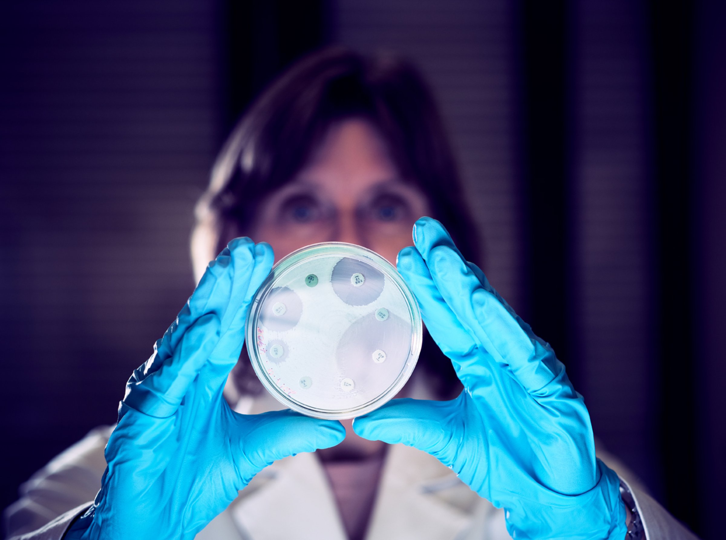 Seniorforsker Marianne Sunde ved Veterinærinstituttet viser petriskål med bakterier der en ser at noen er antibiotikaresistente. Foto: Eivind Røhne