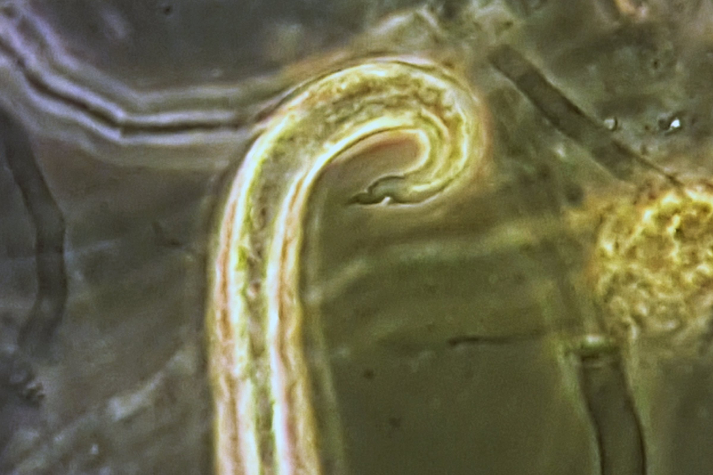 Larve fra Angiostrongylus vasorum (fransk hjerteorm) sett i mikroskop Foto: Inger Sofie Hamnes
