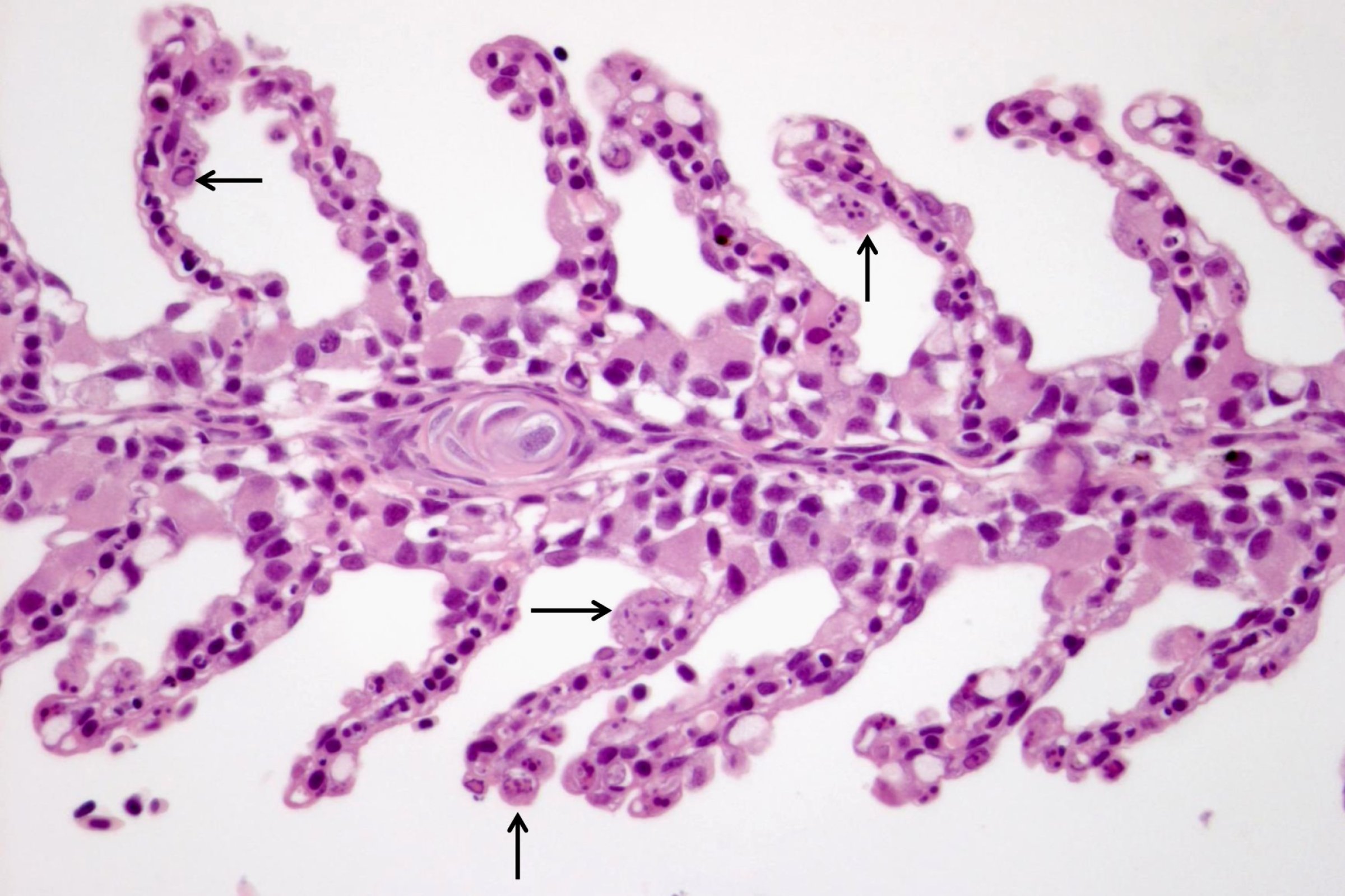 Typiske sykdomsforandringer i gjeller fra laks med laksepox. Foto: Mona Gjessing