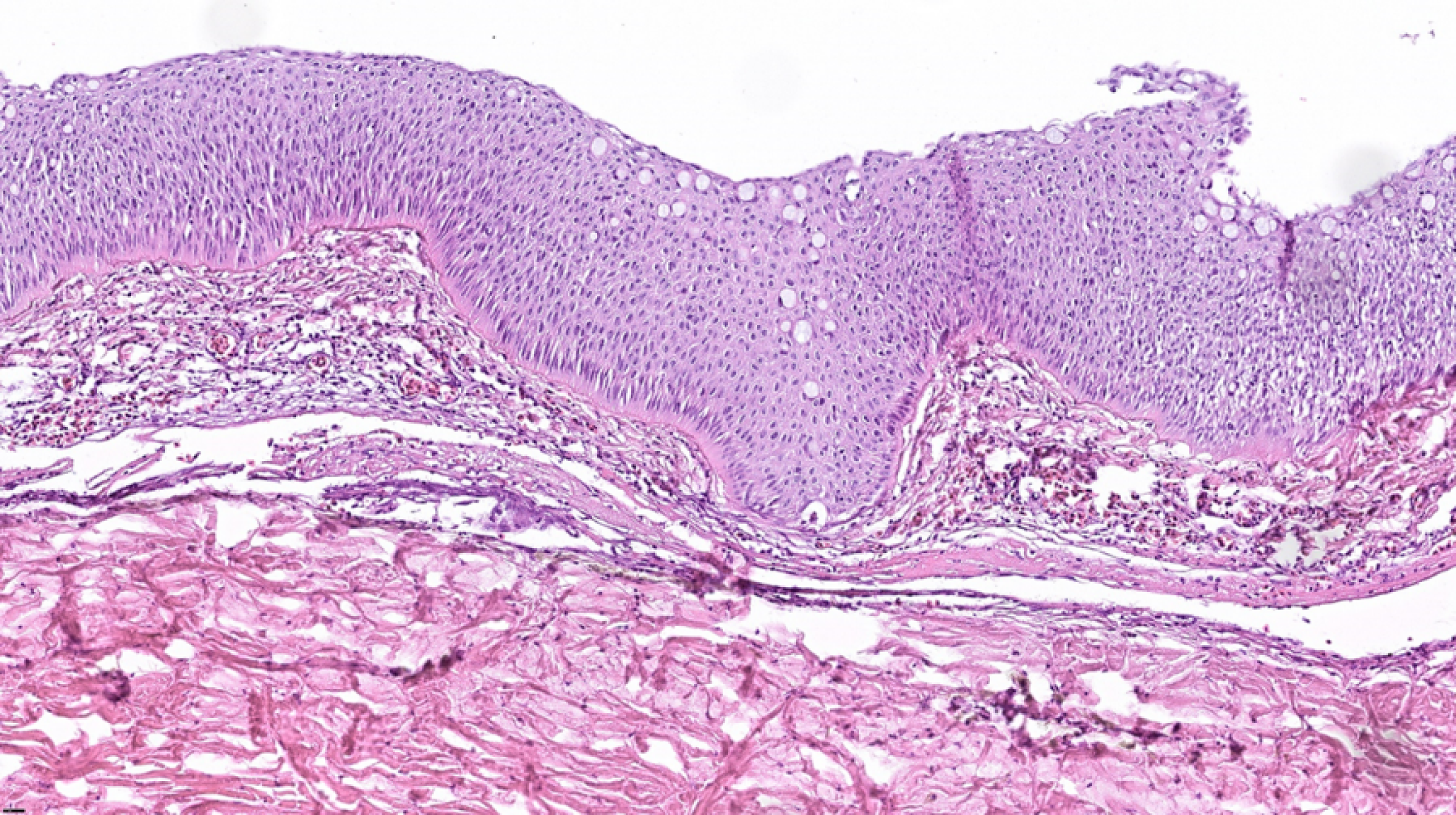 Figur 1: Ytterkant av hudlesjon (fisk fra foto 1), blødninger mellom de to hudlagene epidermis (overhuden) og dermis (lærhuden). Foto: Ole B Dale